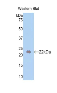 Polyclonal Antibody to Fibroblast Growth Factor 13 (FGF13)