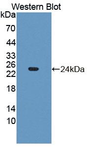 Polyclonal Antibody to Fibroblast Growth Factor 21 (FGF21)