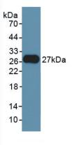 Polyclonal Antibody to Fibroblast Growth Factor 21 (FGF21)