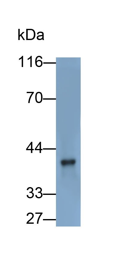 Polyclonal Antibody to Platelet Derived Growth Factor D (PDGFD)