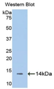 Polyclonal Antibody to Melatonin Receptor 1A (MTNR1A)