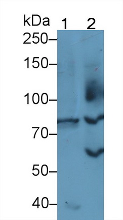 Polyclonal Antibody to Follicle Stimulating Hormone Receptor (FSHR)