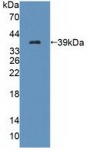 Polyclonal Antibody to Tectorin Beta (TECTb)