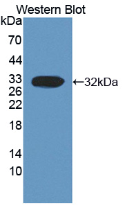 Polyclonal Antibody to Calpain 3 (CAPN3)