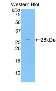 Polyclonal Antibody to Cathepsin C (CTSC)