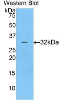 Polyclonal Antibody to Cathepsin V (CTSV)