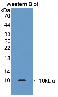 Polyclonal Antibody to Glutathione Peroxidase 3, Plasma (GPX3)