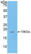 Polyclonal Antibody to Glutathione Peroxidase 4 (GPX4)