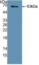 Polyclonal Antibody to Tyrosyl tRNA Synthetase (YARS)