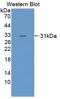 Polyclonal Antibody to Valyl tRNA Synthetase (VARS)