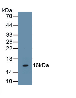 Polyclonal Antibody to Follicle Stimulating Hormone Beta (FSHb)