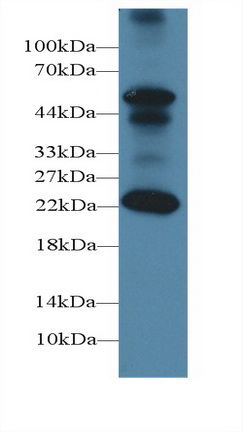 Polyclonal Antibody to Follicle Stimulating Hormone Beta (FSHb)