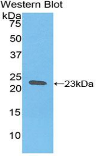 Polyclonal Antibody to Ferritin, Heavy Polypeptide (FTH)