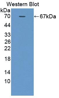 Polyclonal Antibody to Neutral Sphingomyelinase (NSMASE)