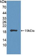 Polyclonal Antibody to Carbonic Anhydrase VII (CA7)