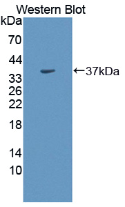 Polyclonal Antibody to Carbonic Anhydrase VIII (CA8)