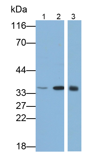 Polyclonal Antibody to Carbonic Anhydrase VIII (CA8)