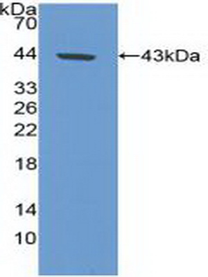 Polyclonal Antibody to Carbonic Anhydrase IX (CA9)