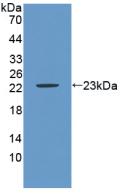 Polyclonal Antibody to Carbonic Anhydrase IX (CA9)