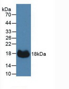 Polyclonal Antibody to Carbonic Anhydrase XII (CA12)