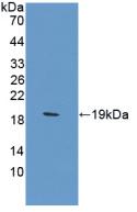 Polyclonal Antibody to Carbonic Anhydrase XII (CA12)