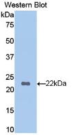 Polyclonal Antibody to Hemoglobin Beta (HBb)