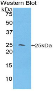 Polyclonal Antibody to Hemoglobin Beta (HBb)