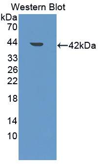 Polyclonal Antibody to Low Density Lipoprotein Receptor Adaptor Protein 1 (LDLRAP1)