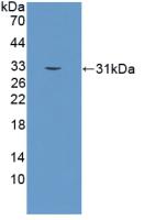 Polyclonal Antibody to Kallikrein 2 (KLK2)