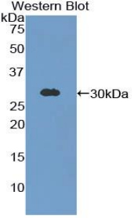 Polyclonal Antibody to Gastric Intrinsic Factor (GIF)