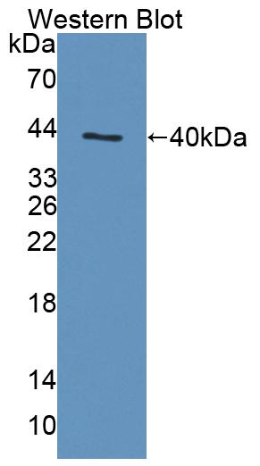 Polyclonal Antibody to Antigen Peptide Transporter 1 (TAP1)