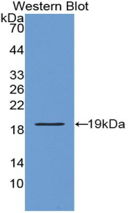 Polyclonal Antibody to Collagen Type VIII Alpha 2 (COL8a2)