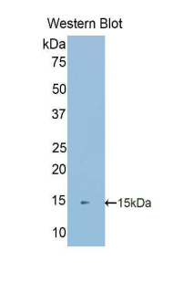 Polyclonal Antibody to S100 Calcium Binding Protein A16 (S100A16)