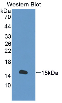 Polyclonal Antibody to S100 Calcium Binding Protein A16 (S100A16)