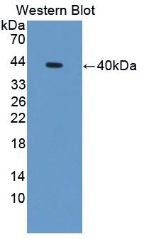 Polyclonal Antibody to S100 Calcium Binding Protein A14 (S100A14)