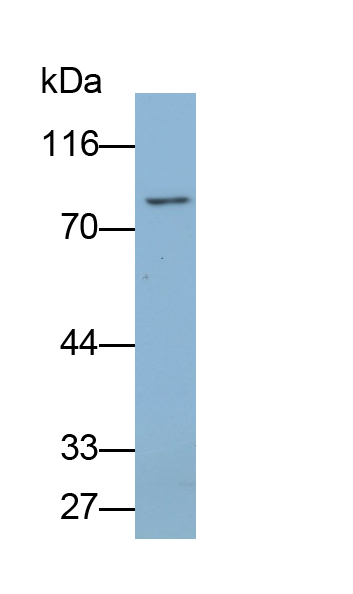 Polyclonal Antibody to Ribonuclease L (RNASEL)