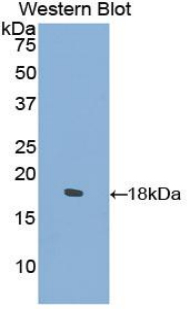 Polyclonal Antibody to Collagen Type II Alpha 1 (COL2a1)