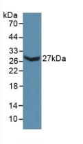 Polyclonal Antibody to Collagen Type III Alpha 1 (COL3a1)