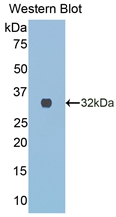 Polyclonal Antibody to Collagen Type III Alpha 1 (COL3a1)