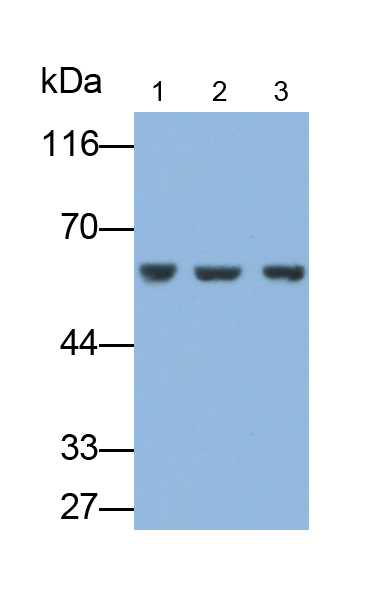 Polyclonal Antibody to Sjogren Syndrome Antigen A2 (SSA2)