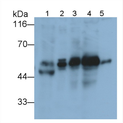 Polyclonal Antibody to Sequestosome 1 (SQSTM1)