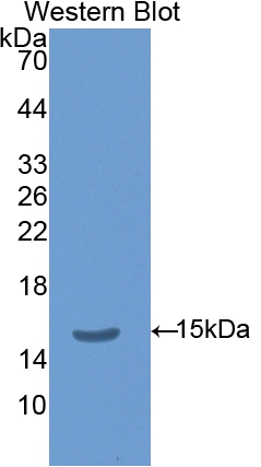 Polyclonal Antibody to Thyroid Stimulating Hormone Beta (TSHb)