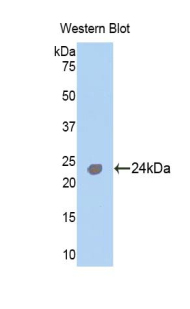 Polyclonal Antibody to Troponin I Type 1, Slow Skeletal (TNNI1)