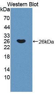 Polyclonal Antibody to Troponin I Type 2, Fast Skeletal (TNNI2)