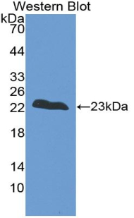 Polyclonal Antibody to Troponin I Type 2, Fast Skeletal (TNNI2)