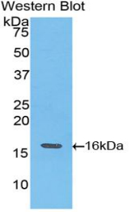 Polyclonal Antibody to Troponin T Type 3, Fast Skeletal (TNNT3)