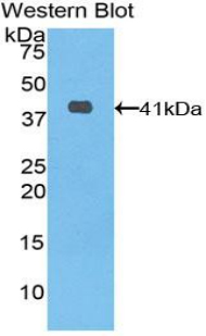 Polyclonal Antibody to Keratin 6A (KRT6A)