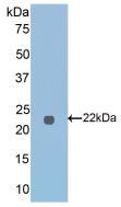 Polyclonal Antibody to Ferritin, Mitochondrial (FTMT)