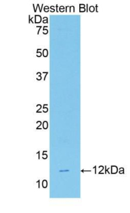 Polyclonal Antibody to Ghrelin/Obestatin Preprohormone (GHRL)