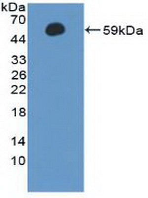 Polyclonal Antibody to Cyclin A1 (CCNA1)